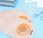Vrećice za ileostomu i prilagodba svakodnevnom životu vrećice za ileostomu